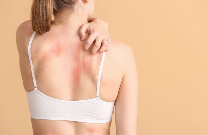 woman itches her back